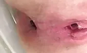 Instragram teen shitting