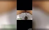 Hairy girl can't stop shitting