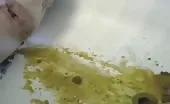 Lots of liquid shit on boyfriend's face