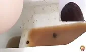 Japanese secretary has serious diarrhea