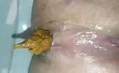 Close up of teen shitting