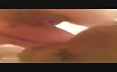 Brown shit from anal prolapsed ass