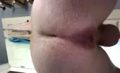 Close up pooping